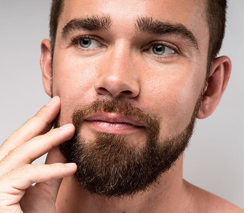 Beard transplant design and implantation