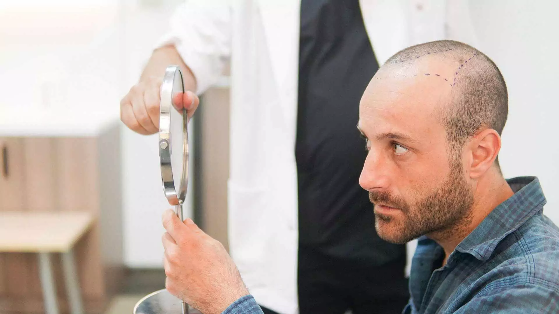 Sapphire FUE hair transplant — micro-channels with sapphire blades
